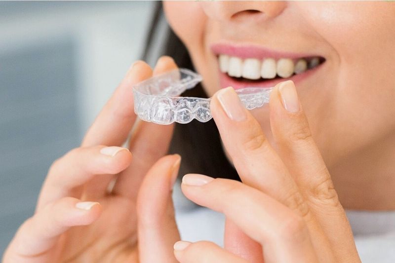 How Much Does Invisalign Cost in Kent, WA?