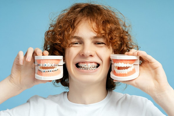 Braces in Advanced Orthodontics in Kent, WA