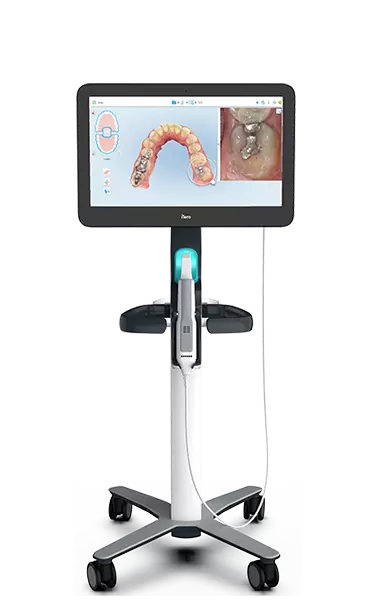 iTero™ Digital Impressions – Speed, Accuracy & Comfort in Kent, WA
